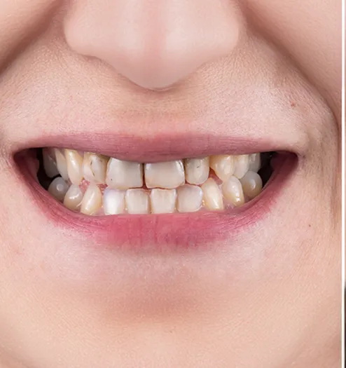 Before cosmetic treatment