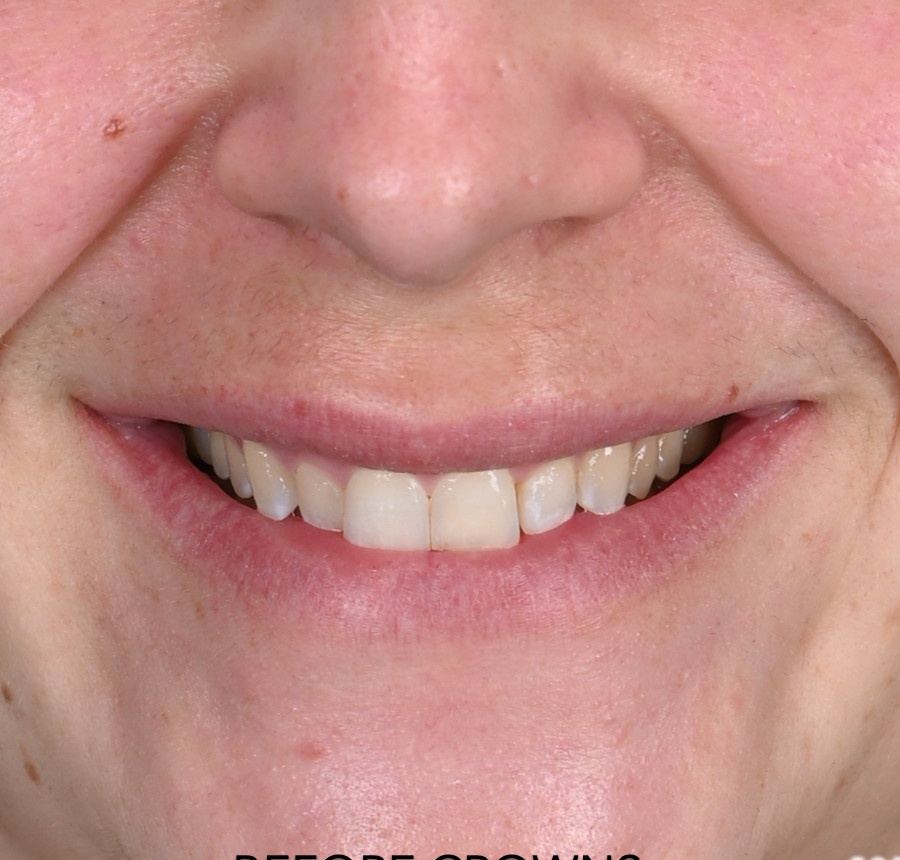 Before cosmetic treatment